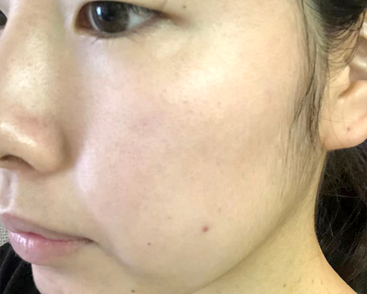 マトリックスエキス　お試し　navis 15日目②